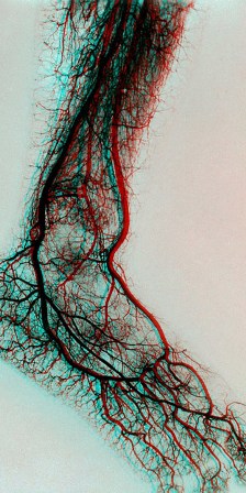 КТ ангиография в Донецке